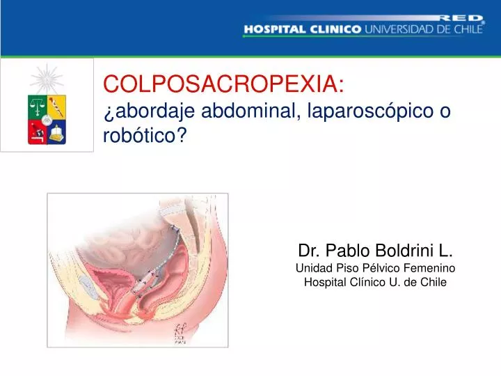colposacropexia abordaje abdominal laparosc pico o rob tico