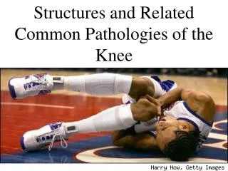 Structures and Related Common Pathologies of the Knee