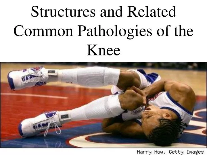 structures and related common pathologies of the knee