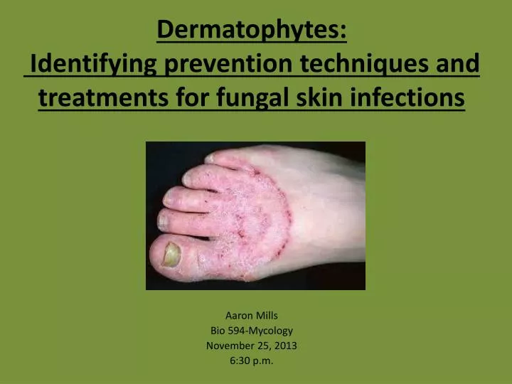 dermatophytes identifying prevention techniques and treatments for fungal skin infections