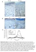 Research on Cathepsin L and Heparanase Activity in Psoriatic Lesions and Macrophage Activation - slide 1