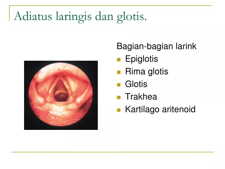 adiatus laringis dan glotis