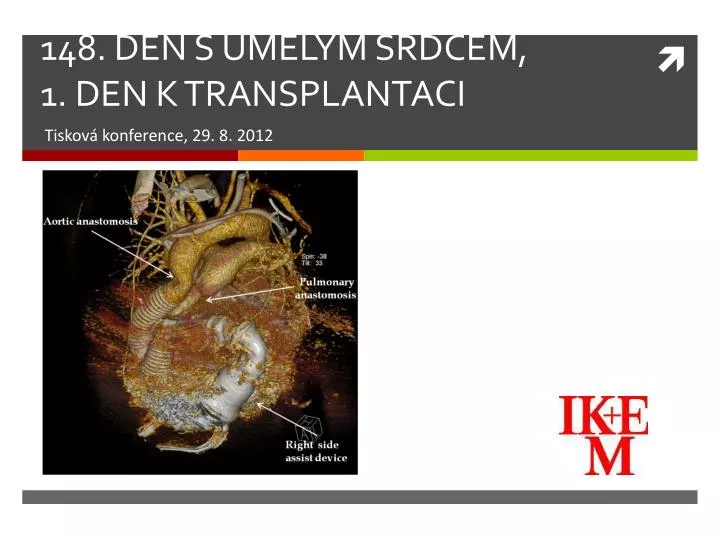 148 den s um l m srdcem 1 den k transplantaci