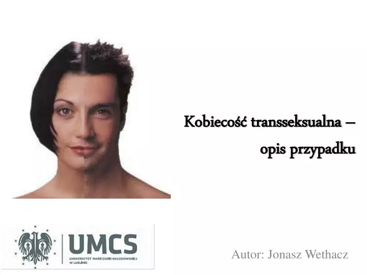 kobieco transseksualna opis przypadku