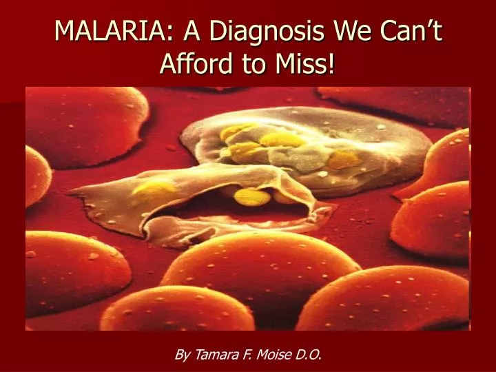 malaria a diagnosis we can t afford to miss