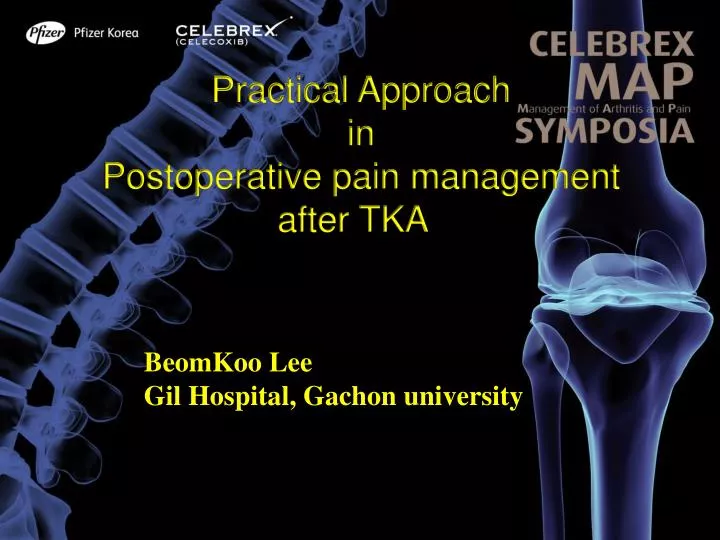 practical approach in postoperative pain management after tka