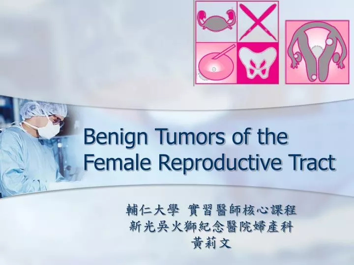 benign tumors of the female reproductive tract