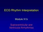 ECG Rhythm Interpretation - slide 1
