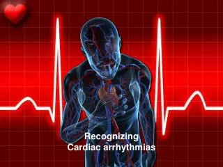 Recognizing Cardiac arrhythmias