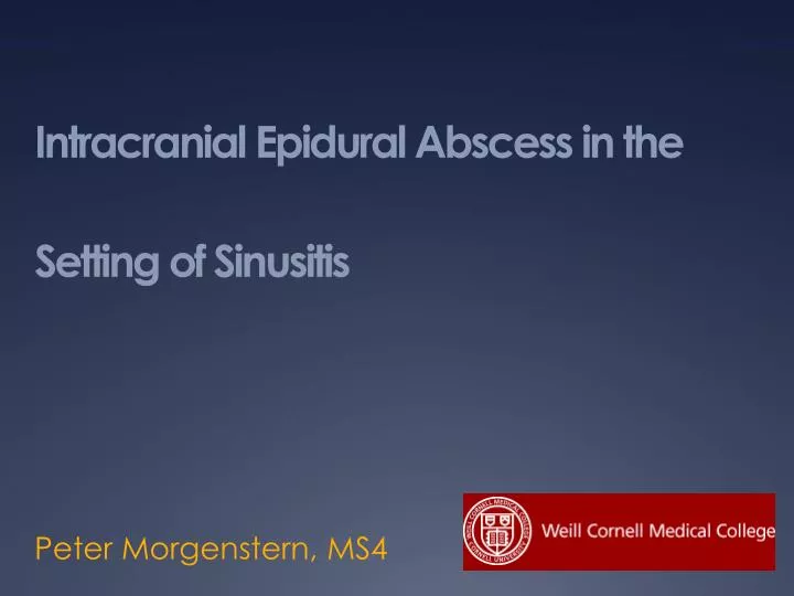 intracranial epidural abscess in the setting of sinusitis