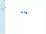 Vitiligo - slide 1