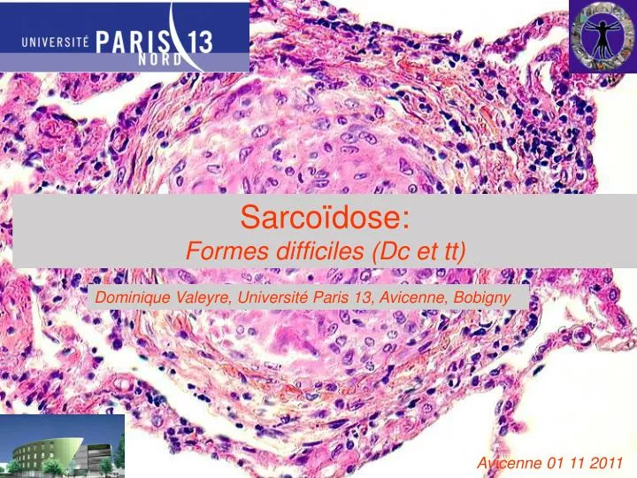 sarco dose pulmonaire s v re