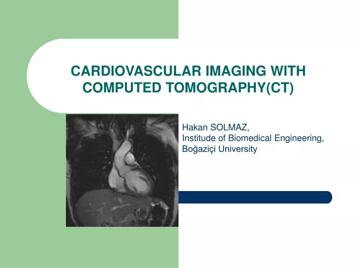 cardiovascular imaging with computed tomography ct