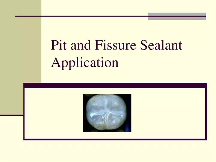 pit and fissure sealant application