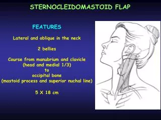 STERNOCLEIDOMASTOID FLAP