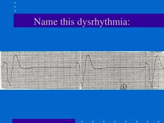 Name this dysrhythmia:
