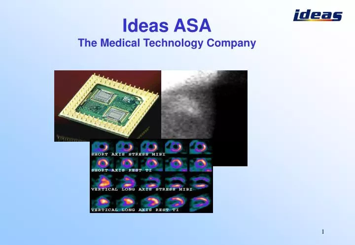 i deas asa the medical technology company