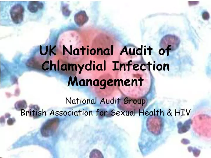 uk national audit of chlamydial infection management