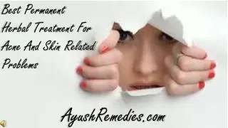 Best Permanent Herbal Treatment For Acne And Skin Related Pr