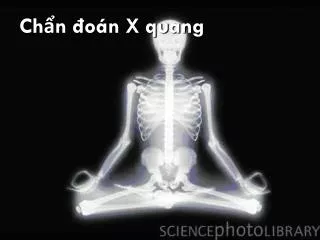ch n o n x quang