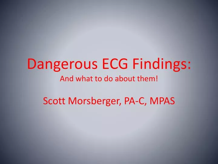 dangerous ecg findings and what to do about them
