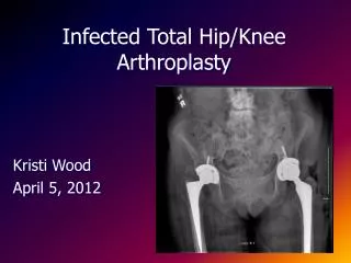 Infected Total Hip/Knee Arthroplasty
