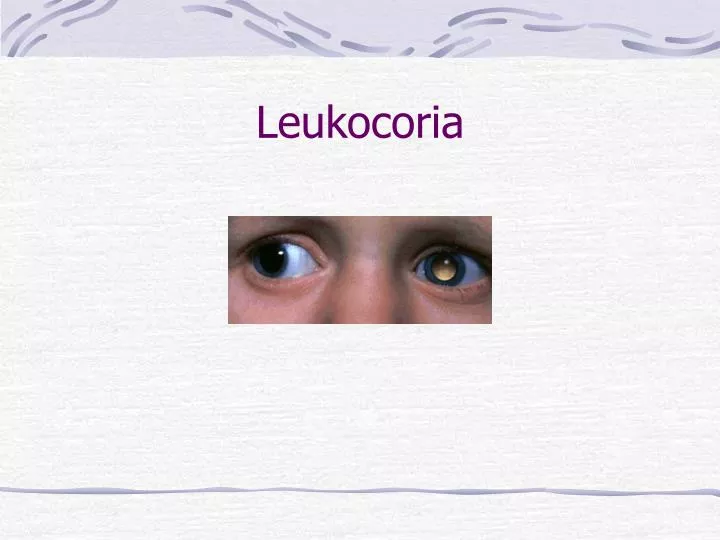 leukocoria