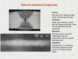 yetersiz n fuziyet x a z nda