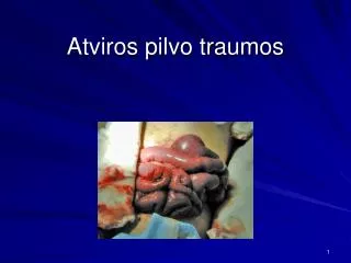 atviros pilvo traumos