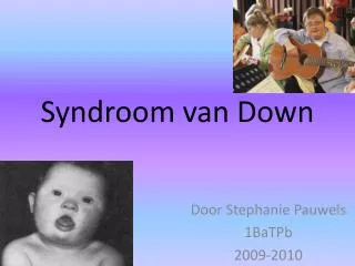 syndroom van down