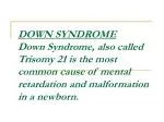 CHARACTERISTICS - slide 1