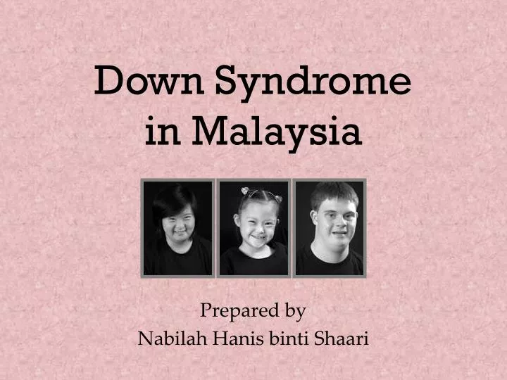 down syndrome in malaysia