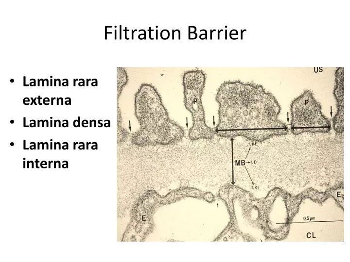 filtration barrier