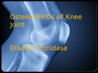 Osteoarthritis of Knee joint Dilshan Munidasa