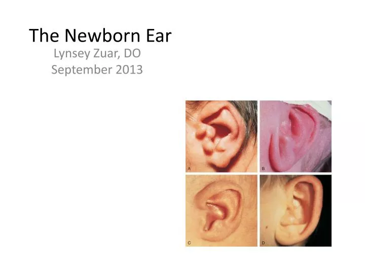 the newborn ear