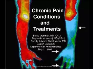 Chronic Pain Conditions and Treatments