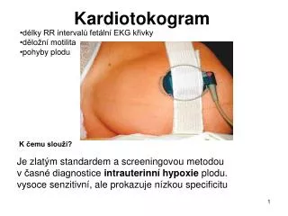 kardiotokogram