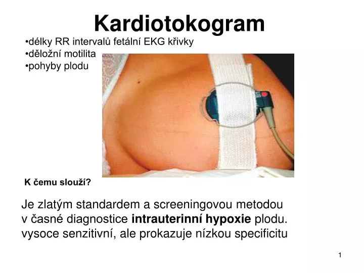 kardiotokogram