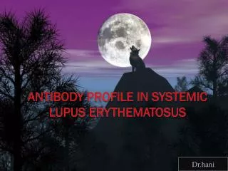 Antibody profile in Systemic Lupus Erythematosus