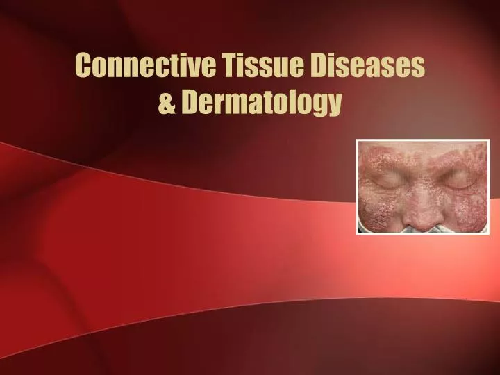 connective tissue diseases dermatology