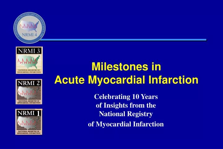 milestones in acute myocardial infarction