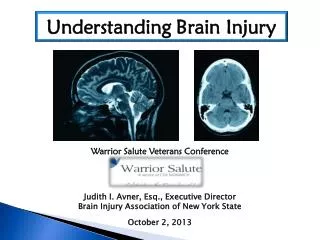 Understanding Brain Injury