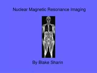Nuclear Magnetic Resonance Imaging