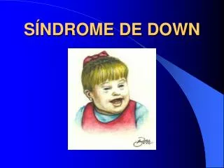 s ndrome de down