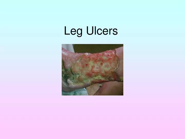 leg ulcers
