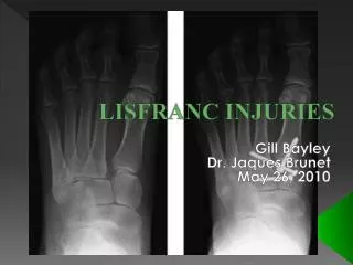 LISFRANC INJURIES