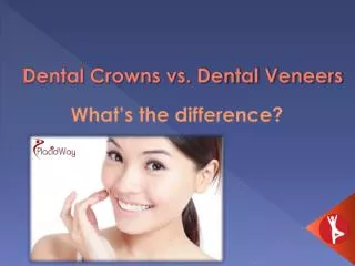 Dental Crowns VS. Dental Veneers | Affordable Dental Implant