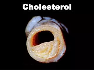 Cholesterol