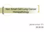 Non Small Cell Lung Cancer Histopathology - slide 1