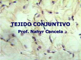 tejido conjuntivo prof nahyr cancela
